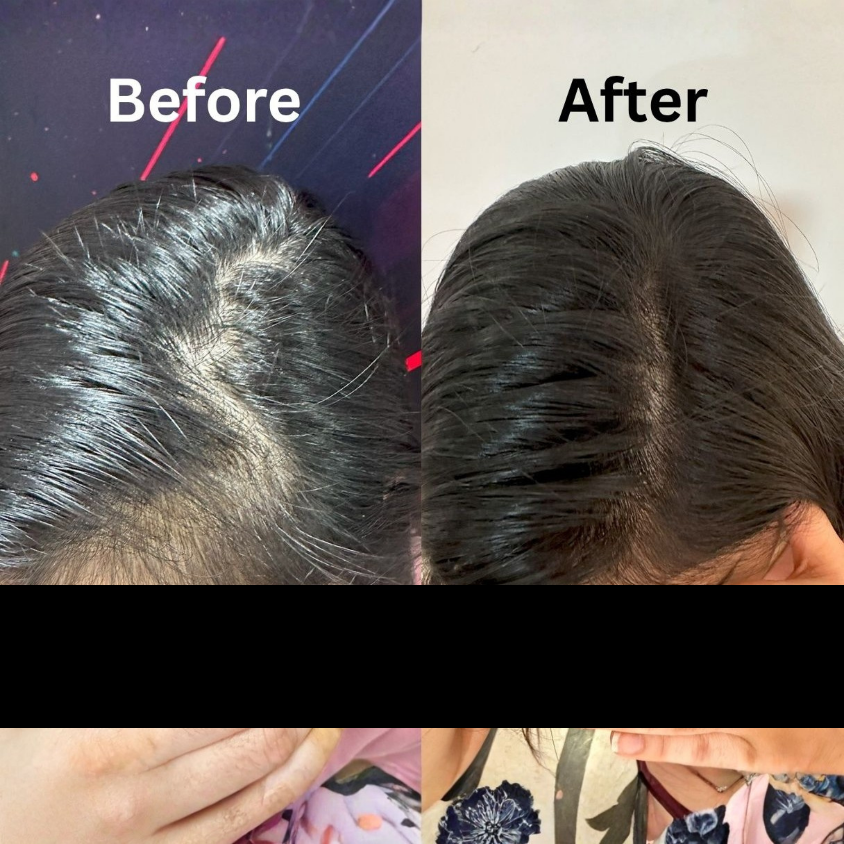 SAYY Hair Strength & Regrowth Combo – Nourishing Oil + Advanced Hair Serum